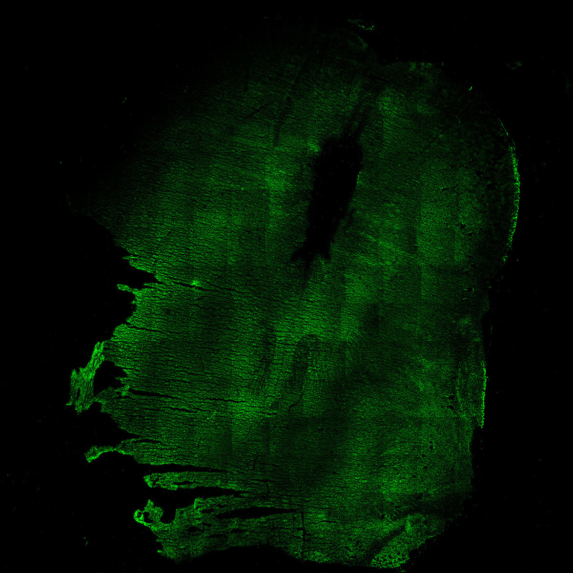 Human foetal midbrain